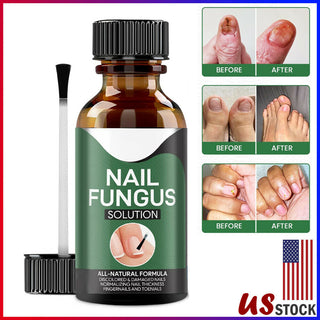 Anti Fungal Nail Treatment