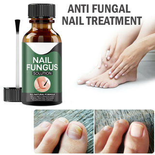 Anti Fungal Nail Treatment