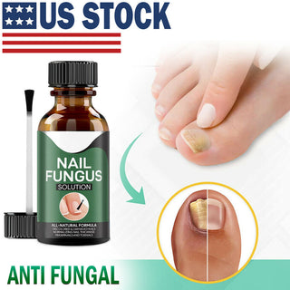 Anti Fungal Nail Treatment