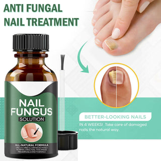 Anti Fungal Nail Treatment